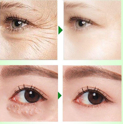 Meilin Eye Cream 15g To Reduce Dark Circles Under The Eyes